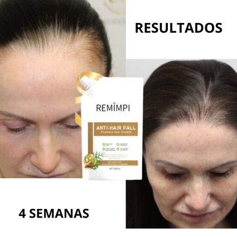 Shampoo regenerador de cabello